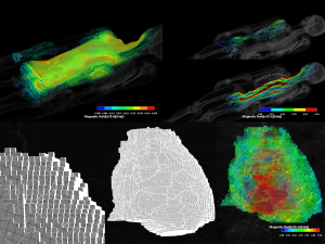 Parallel Finite Element Analysis of Numerical Human Body Model with 16 Billion DOFs